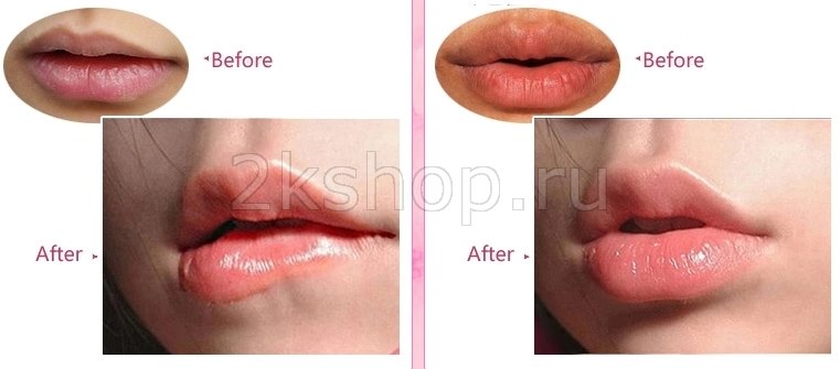 Tony Moly Kiss Kiss lovely lip patch